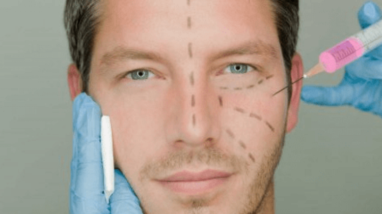 Men And Plastic Surgery
